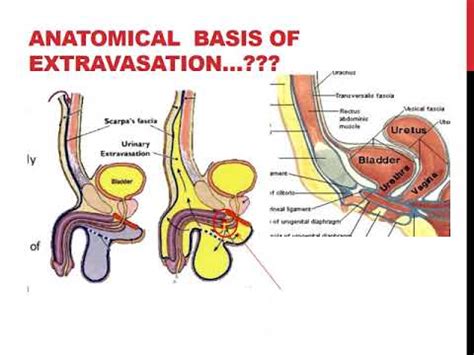 what is a gooch on the human body male|Perineum: Location, Anatomy, Function & Conditions